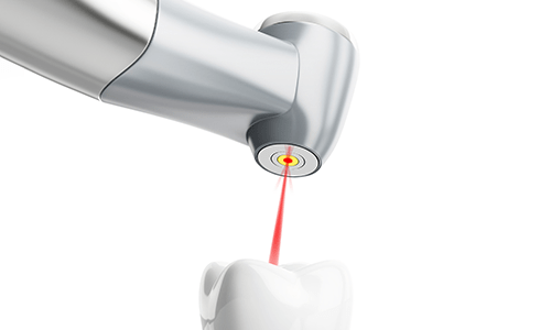 Laser Stomatolog Dentist Artial Dent